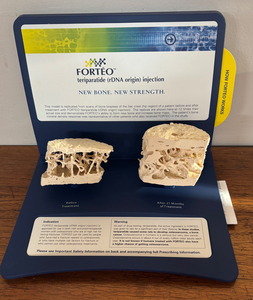 FORTEO New Bone, New Strength model