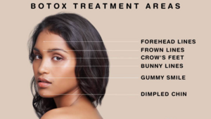 Botox Treatments at LaserAway