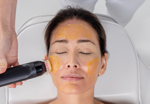 RF (radio frequency) Facial