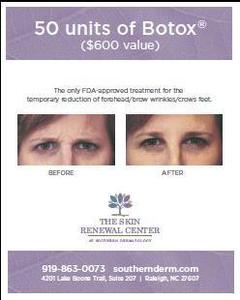 Botox Package - $600 Value