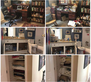 Before and after gallery s300