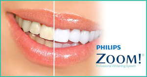 Zoom Teeth Whitening - Pathways NE Clinic