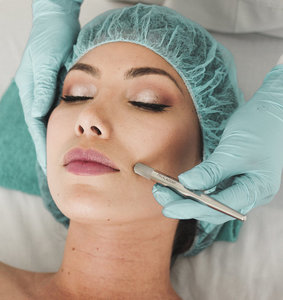 Facial - Microdermabrasion